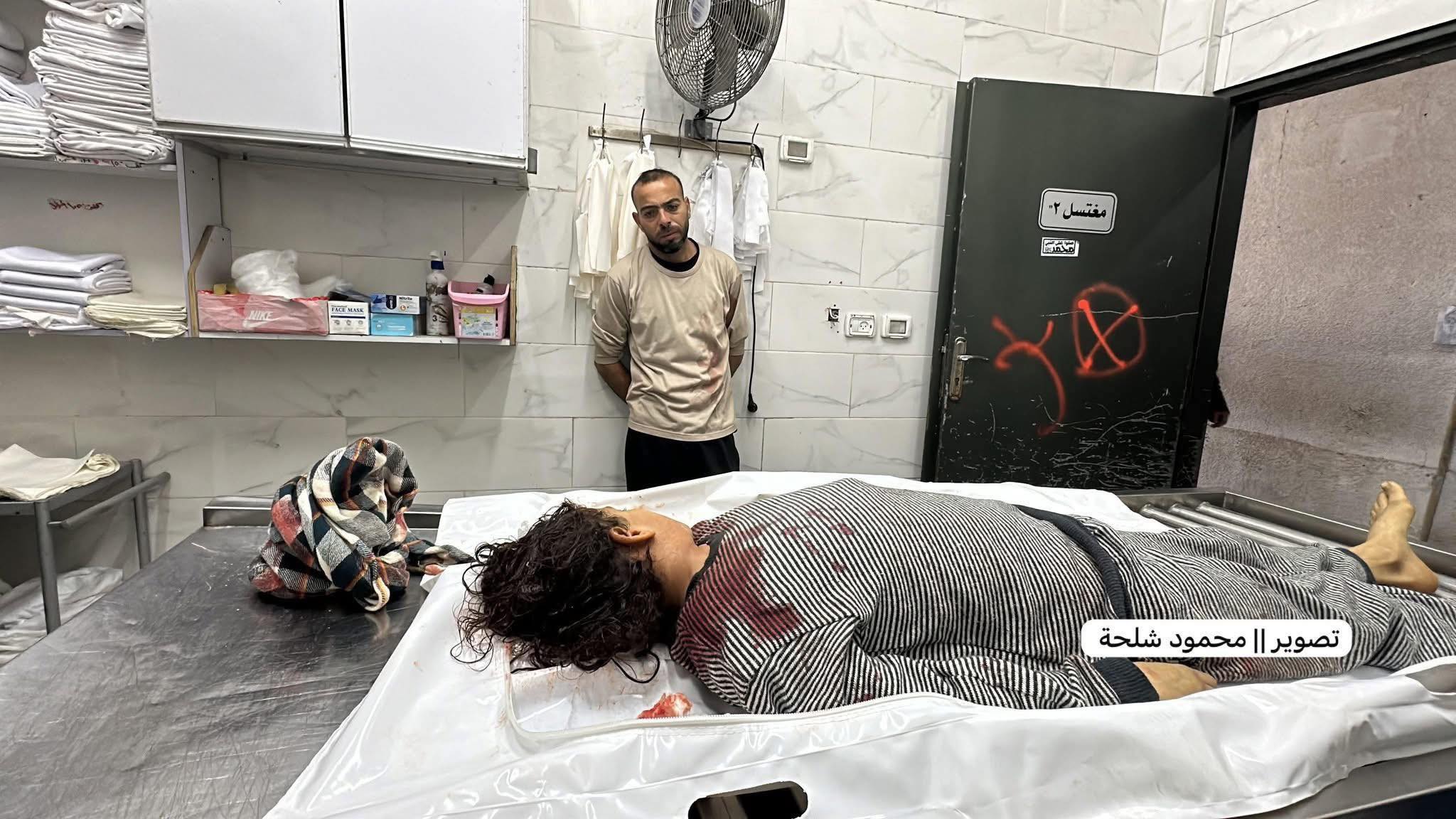 استشهاد الطفلة صبا الحشاش متأثرة بإصابتها برصاص الاحتلال  بمواصي خان يونس